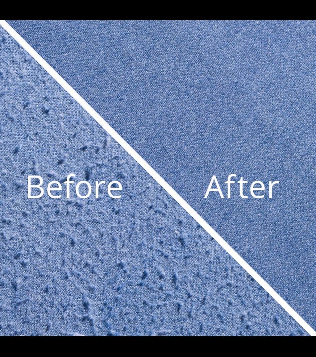 Electric Lint Remover – Restore Your Clothes Instantly